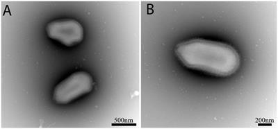 Orpheovirus IHUMI-LCC2: A New Virus among the Giant Viruses